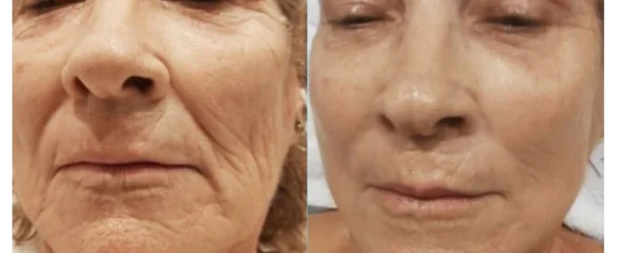 Facial with Casmara Skin Care service image